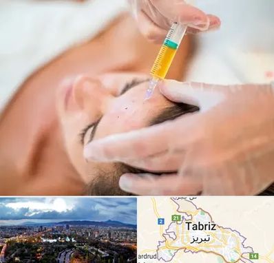 پی آر پی در تبریز