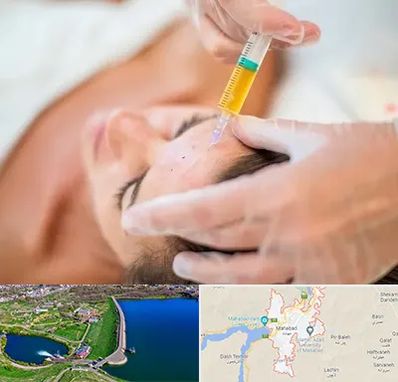 پی آر پی در مهاباد