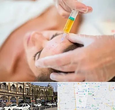 پی آر پی در منطقه 11 تهران 