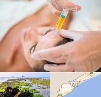 پی آر پی در بندرلنگه