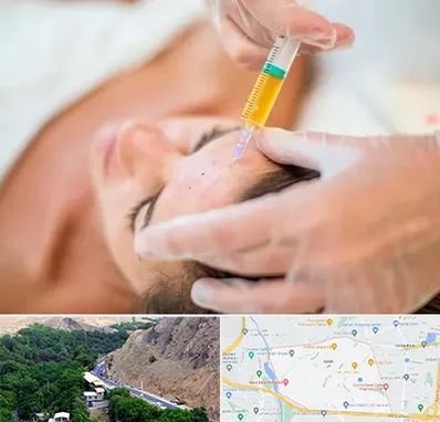 پی آر پی در کن 