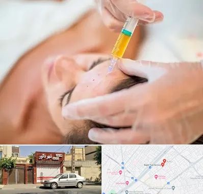 پی آر پی در باجک قم