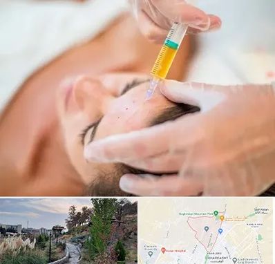 پی آر پی در باغستان کرج