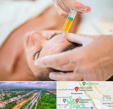 پی آر پی در قصرالدشت شیراز