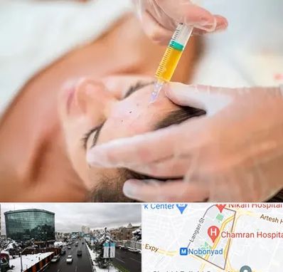 پی آر پی در اقدسیه 