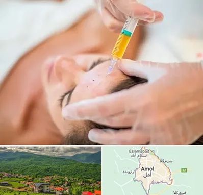 پی آر پی در آمل