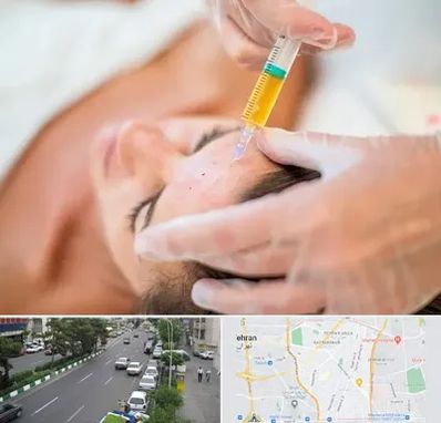 پی آر پی در ستارخان 