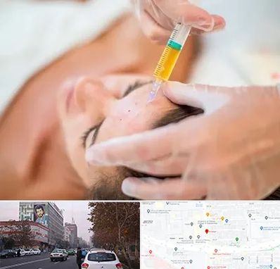 پی آر پی در کارگر شمالی 