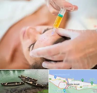 پی آر پی در بندر انزلی