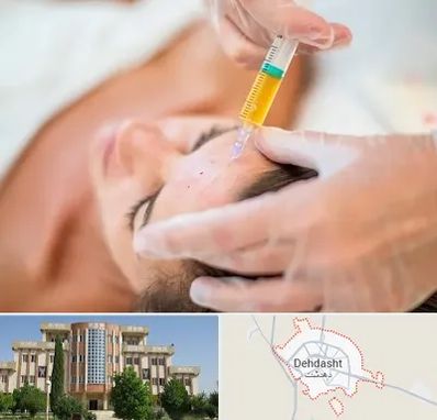 پی آر پی در دهدشت