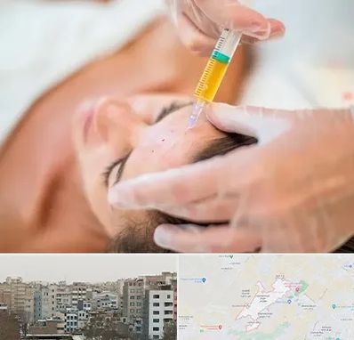 پی آر پی در محمد شهر کرج