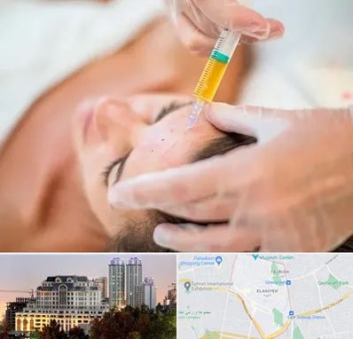 پی آر پی در فرشته 