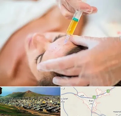 پی آر پی در بیجار