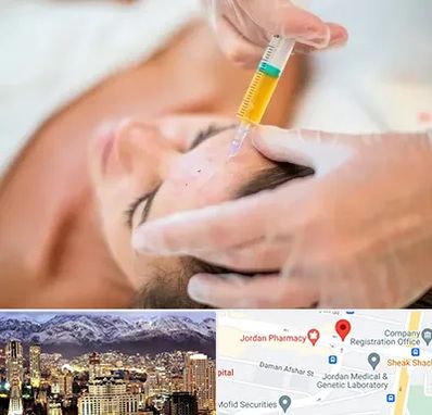 پی آر پی در جردن 