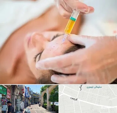 پی آر پی در خیابان قزوین