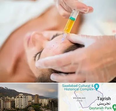 پی آر پی در زعفرانیه 