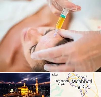 پی آر پی در مشهد