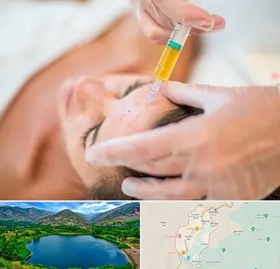 پی آر پی در رودبار