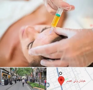 پی آر پی در ولیعصر شهریار