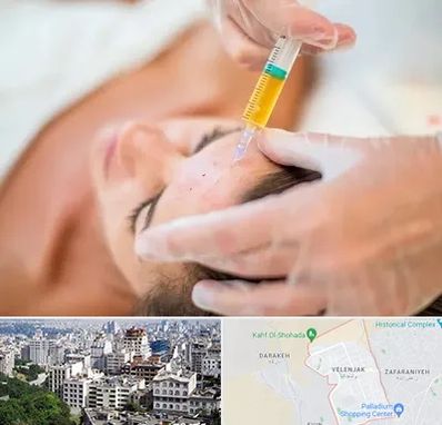 پی آر پی در ولنجک 