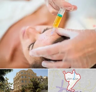 پی آر پی در مینی سیتی