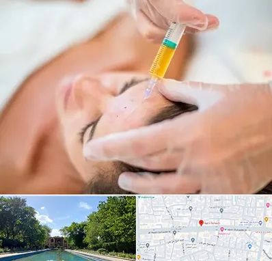 پی آر پی در هشت بهشت اصفهان