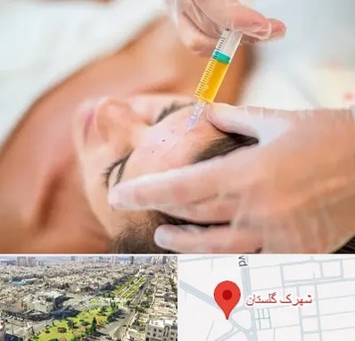 پی آر پی در شهرک گلستان