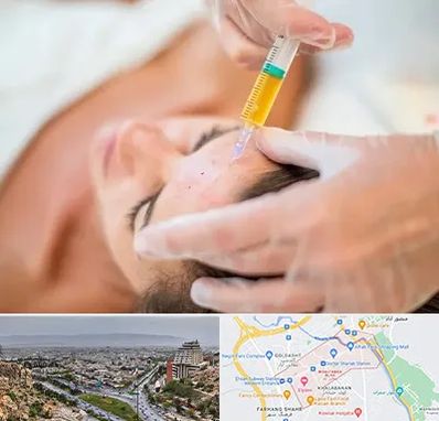 پی آر پی در معالی آباد شیراز