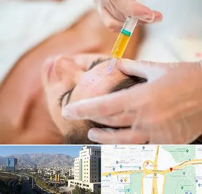 پی آر پی در حقانی 