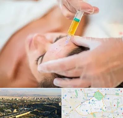 پی آر پی در منطقه 19 تهران 