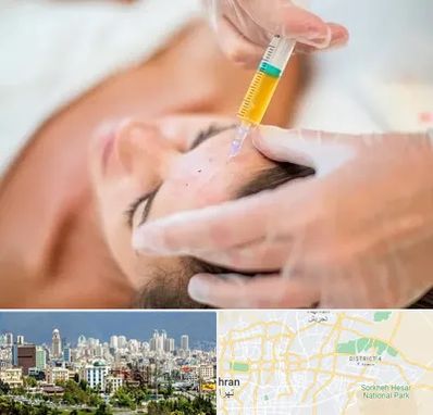 پی آر پی در شرق تهران 