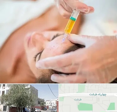 پی آر پی در طرشت