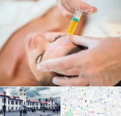 پی آر پی در میدان شهرداری رشت