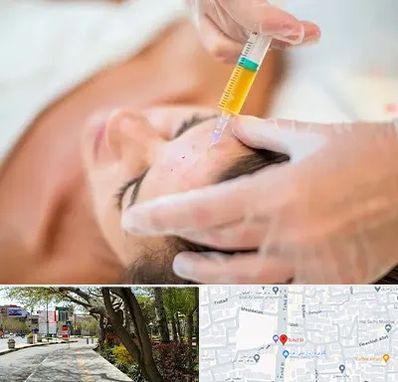 پی آر پی در خیابان توحید اصفهان