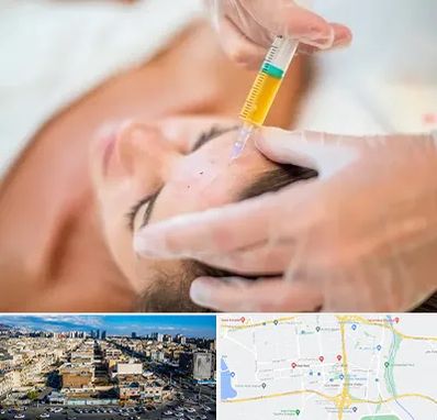 پی آر پی در شهرک راه آهن