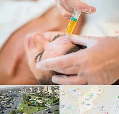 پی آر پی در کمال شهر کرج