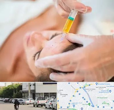 پی آر پی در قدوسی شرقی شیراز