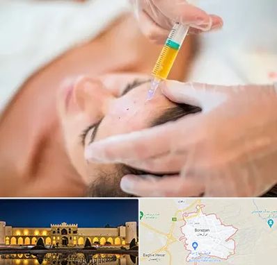 پی آر پی در برازجان