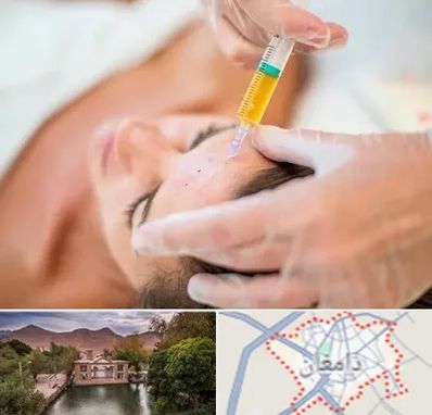 پی آر پی در دامغان