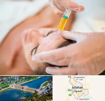 پی آر پی در اصفهان