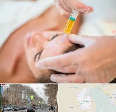 پی آر پی در نظرآباد کرج