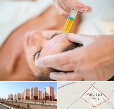 پی آر پی در پردیسان قم