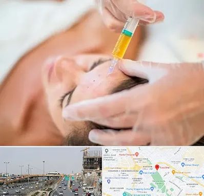 پی آر پی در بلوار توس مشهد