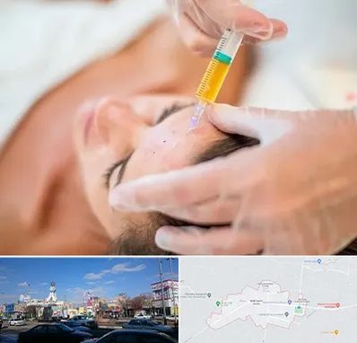 پی آر پی در ماهدشت کرج