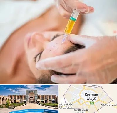 پی آر پی در کرمان
