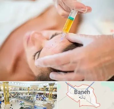 پی آر پی در بانه