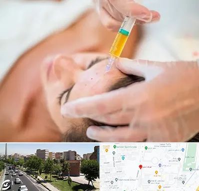 پی آر پی در شهرک آزمایش 