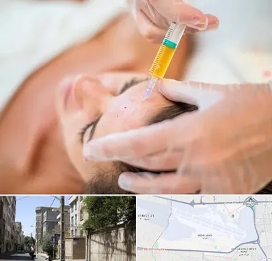 پی آر پی در مهرآباد