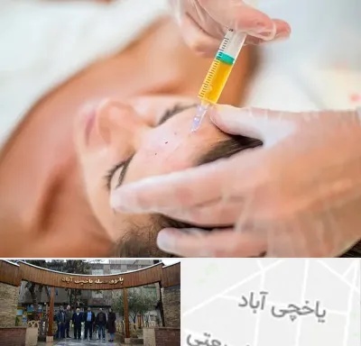 پی آر پی در یاخچی آباد