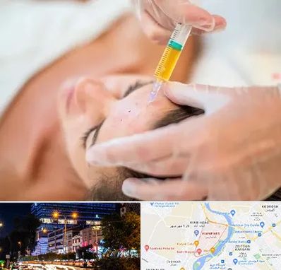 پی آر پی در کیانپارس اهواز